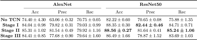 Figure 2 for TeCNO: Surgical Phase Recognition with Multi-Stage Temporal Convolutional Networks