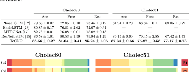 Figure 3 for TeCNO: Surgical Phase Recognition with Multi-Stage Temporal Convolutional Networks