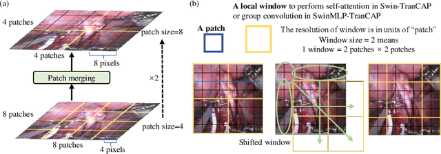 Figure 3 for Rethinking Surgical Captioning: End-to-End Window-Based MLP Transformer Using Patches