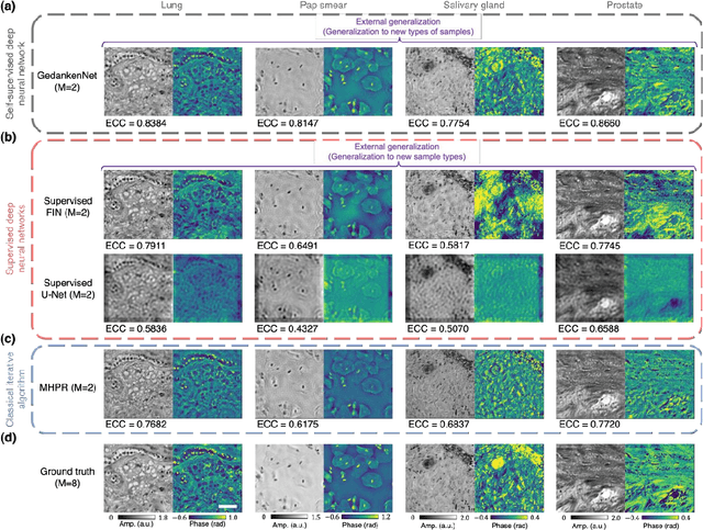 Figure 3 for GedankenNet: Self-supervised learning of hologram reconstruction using physics consistency