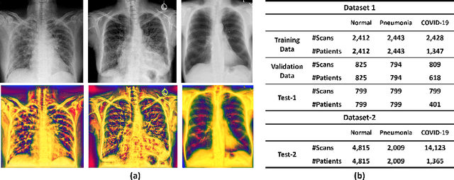 Figure 1 for Multi-Feature Vision Transformer via Self-Supervised Representation Learning for Improvement of COVID-19 Diagnosis