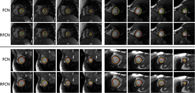 Figure 4 for Recurrent Fully Convolutional Neural Networks for Multi-slice MRI Cardiac Segmentation
