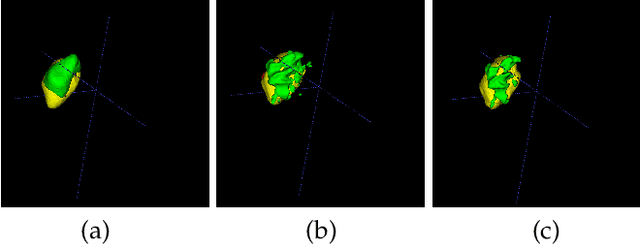 Figure 1 for KiU-Net: Overcomplete Convolutional Architectures for Biomedical Image and Volumetric Segmentation