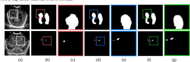Figure 3 for KiU-Net: Overcomplete Convolutional Architectures for Biomedical Image and Volumetric Segmentation