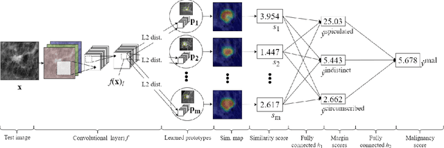 Figure 3 for Interpretable Mammographic Image Classification using Cased-Based Reasoning and Deep Learning