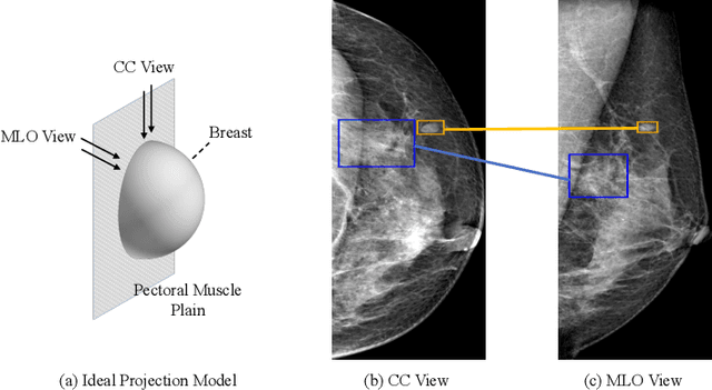 Figure 1 for Check and Link: Pairwise Lesion Correspondence Guides Mammogram Mass Detection