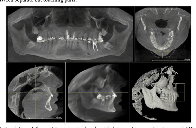 Figure 2 for The dynamics of the stomatognathic system from 4D multimodal data