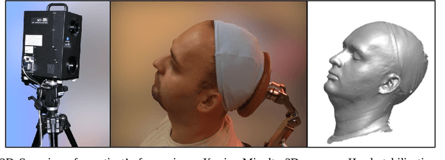 Figure 4 for The dynamics of the stomatognathic system from 4D multimodal data