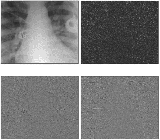 Figure 4 for Preservation of High Frequency Content for Deep Learning-Based Medical Image Classification