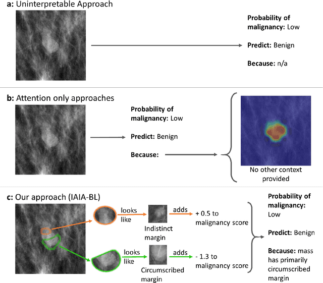 Figure 1 for IAIA-BL: A Case-based Interpretable Deep Learning Model for Classification of Mass Lesions in Digital Mammography