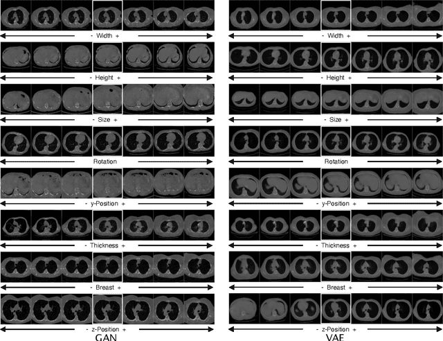 Figure 2 for Interpreting Latent Spaces of Generative Models for Medical Images using Unsupervised Methods