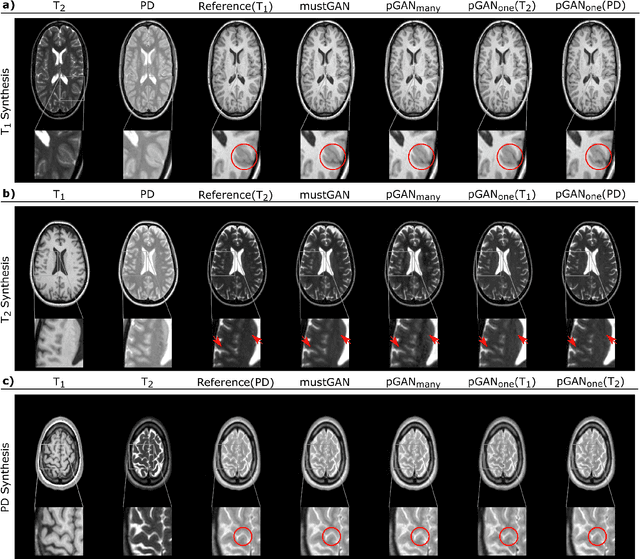 Figure 2 for mustGAN: Multi-Stream Generative Adversarial Networks for MR Image Synthesis