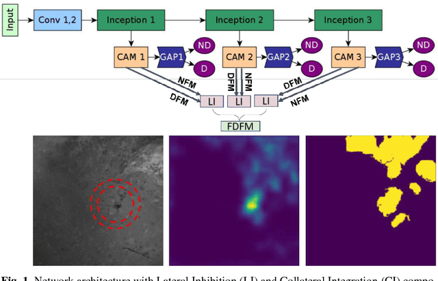 Figure 1 for Weakly-Supervised Learning-Based Feature Localization in Confocal Laser Endomicroscopy Glioma Images