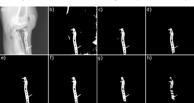 Figure 2 for Learning-Based Patch-Wise Metal Segmentation with Consistency Check