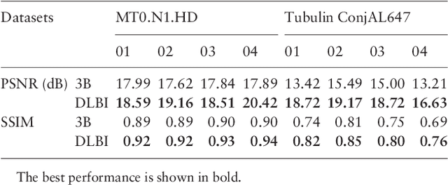 Figure 2 for DLBI: Deep learning guided Bayesian inference for structure reconstruction of super-resolution fluorescence microscopy