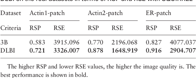 Figure 4 for DLBI: Deep learning guided Bayesian inference for structure reconstruction of super-resolution fluorescence microscopy