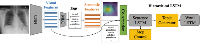 Figure 3 for On the Automatic Generation of Medical Imaging Reports