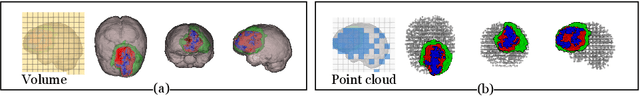 Figure 1 for Point-Unet: A Context-aware Point-based Neural Network for Volumetric Segmentation