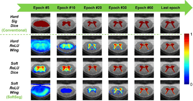 Figure 4 for SoftSeg: Advantages of soft versus binary training for image segmentation