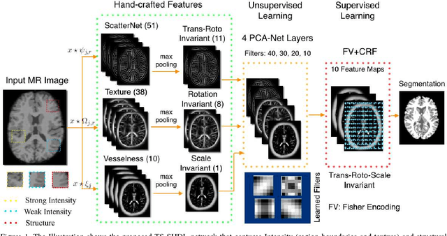 Figure 1 for Texture and Structure Incorporated ScatterNet Hybrid Deep Learning Network (TS-SHDL) For Brain Matter Segmentation