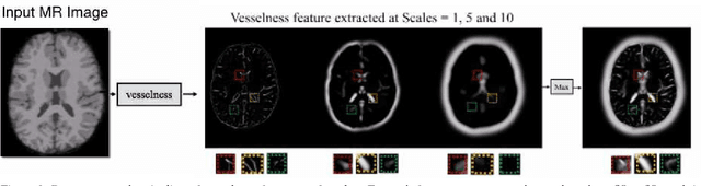 Figure 3 for Texture and Structure Incorporated ScatterNet Hybrid Deep Learning Network (TS-SHDL) For Brain Matter Segmentation