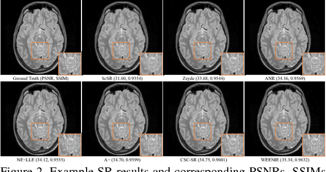 Figure 3 for Simultaneous Super-Resolution and Cross-Modality Synthesis of 3D Medical Images using Weakly-Supervised Joint Convolutional Sparse Coding