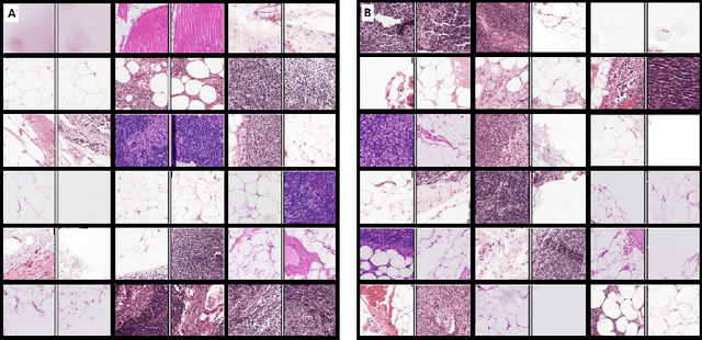 Figure 1 for Self-Supervised Similarity Learning for Digital Pathology