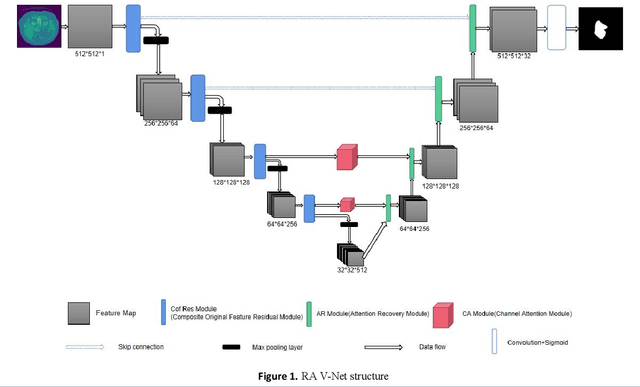 Figure 1 for RA V-Net: Deep learning network for automated liver segmentation