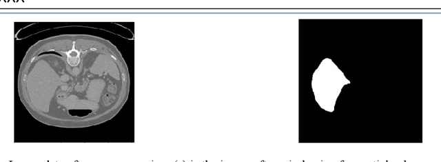 Figure 2 for RA V-Net: Deep learning network for automated liver segmentation