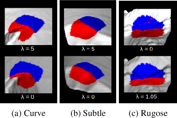 Figure 1 for The Virtual Goniometer: A new method for measuring angles on 3D models of fragmentary bone and lithics