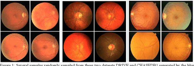 Figure 1 for Contextual Information Enhanced Convolutional Neural Networks for Retinal Vessel Segmentation in Color Fundus Images