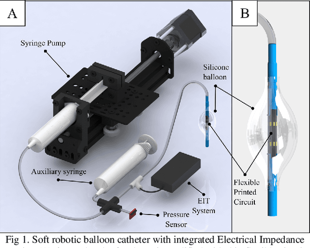 Figure 1 for Lumen Shape Reconstruction using a Soft Robotic Balloon Catheter and Electrical Impedance Tomography