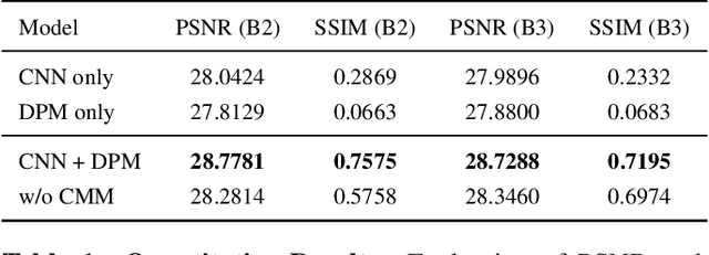 Figure 2 for Differentiable Projection from Optical Coherence Tomography B-Scan without Retinal Layer Segmentation Supervision