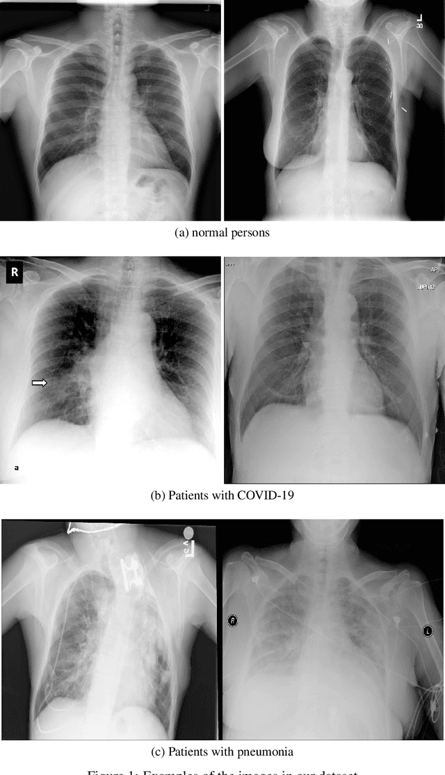 Figure 2 for A New Modified Deep Convolutional Neural Network for Detecting COVID-19 from X-ray Images