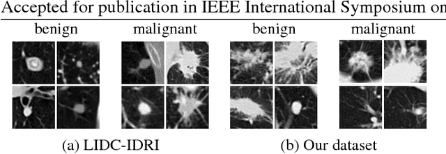 Figure 3 for Diagnostic Classification Of Lung Nodules Using 3D Neural Networks
