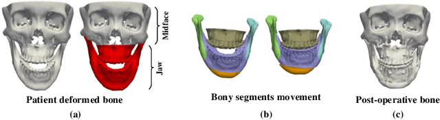 Figure 1 for A Self-Supervised Deep Framework for Reference Bony Shape Estimation in Orthognathic Surgical Planning