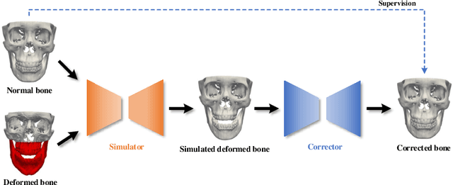 Figure 3 for A Self-Supervised Deep Framework for Reference Bony Shape Estimation in Orthognathic Surgical Planning