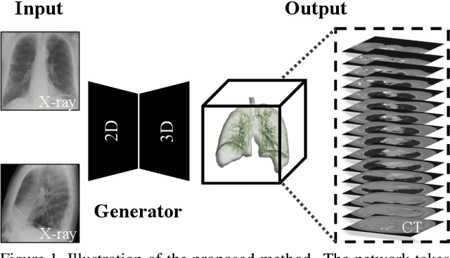 Figure 1 for X2CT-GAN: Reconstructing CT from Biplanar X-Rays with Generative Adversarial Networks