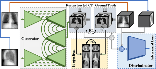Figure 3 for X2CT-GAN: Reconstructing CT from Biplanar X-Rays with Generative Adversarial Networks
