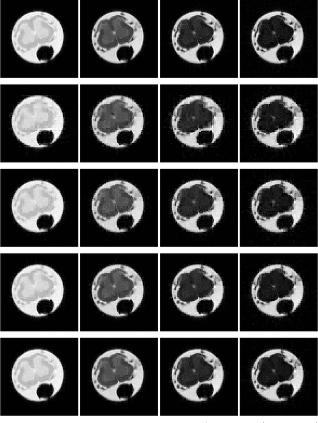 Figure 3 for Reconstructing Multi-echo Magnetic Resonance Images via Structured Deep Dictionary Learning