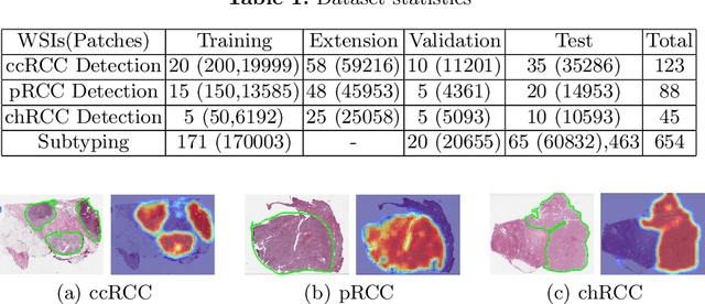 Figure 2 for Renal Cell Carcinoma Detection and Subtyping with Minimal Point-Based Annotation in Whole-Slide Images