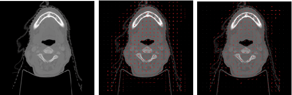 Figure 3 for Wasserstein Image Local Analysis: Histogram of Orientations, Smoothing and Edge Detection