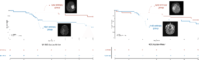 Figure 4 for Wasserstein Image Local Analysis: Histogram of Orientations, Smoothing and Edge Detection