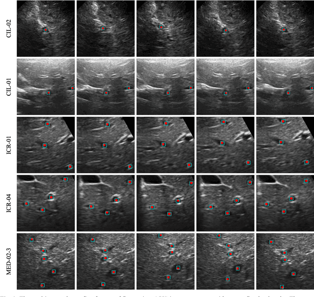 Figure 3 for Landmark Tracking in Liver US images Using Cascade Convolutional Neural Networks with Long Short-Term Memory