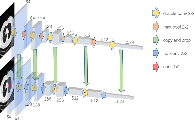 Figure 3 for To what extent can Plug-and-Play methods outperform neural networks alone in low-dose CT reconstruction