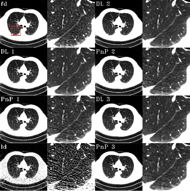 Figure 4 for To what extent can Plug-and-Play methods outperform neural networks alone in low-dose CT reconstruction