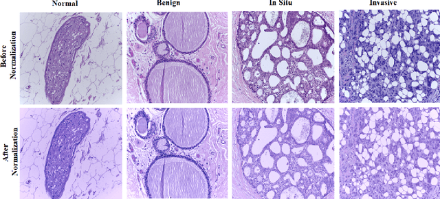Figure 1 for Classification of breast cancer histology images using transfer learning