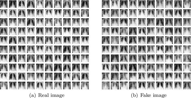 Figure 3 for FedDPGAN: Federated Differentially Private Generative Adversarial Networks Framework for the Detection of COVID-19 Pneumonia