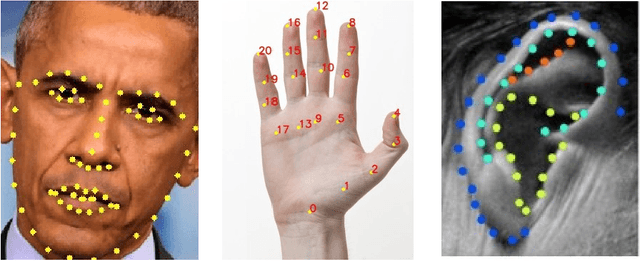 Figure 1 for Atypical Facial Landmark Localisation with Stacked Hourglass Networks: A Study on 3D Facial Modelling for Medical Diagnosis