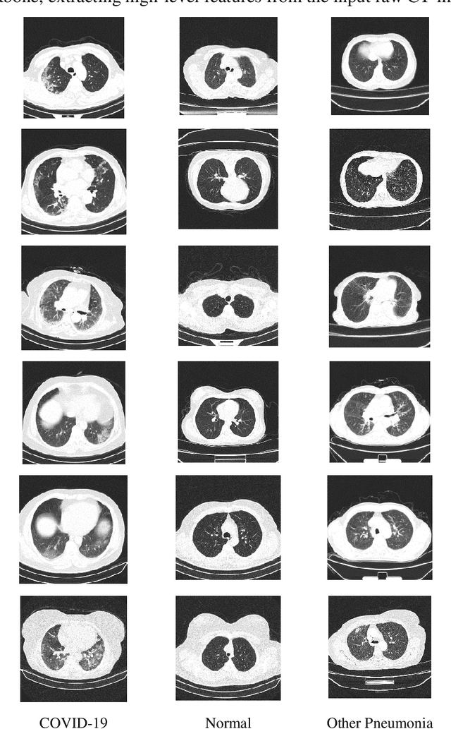 Figure 3 for Screening COVID-19 Based on CT/CXR Images & Building a Publicly Available CT-scan Dataset of COVID-19